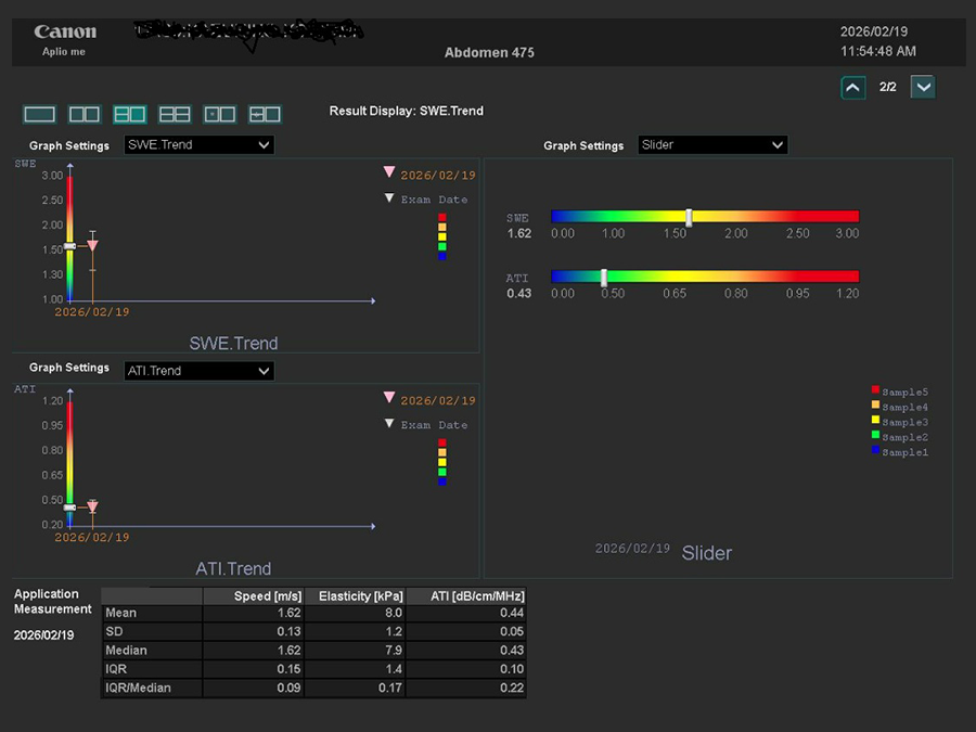 超音波検査装置（エラストグラフィ）